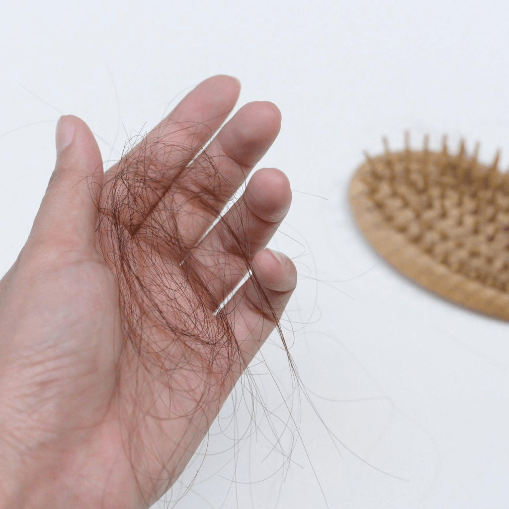 빠진 머리카락을 잡고 있는 사진