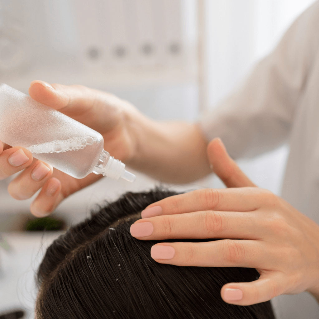 두피 영양 보호제를 머리에 발라주고 있는 사진